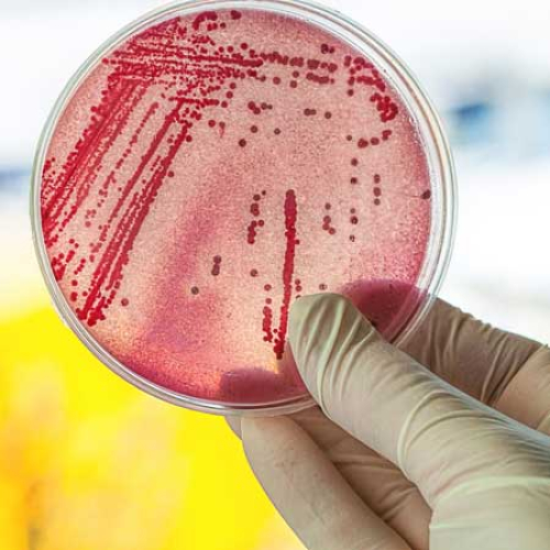 Колиформные бактерии в питьевой воде, скважинах и колодцах